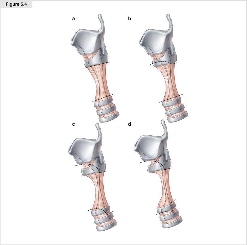 A194303_1_En_5_Fig4_HTML.jpg