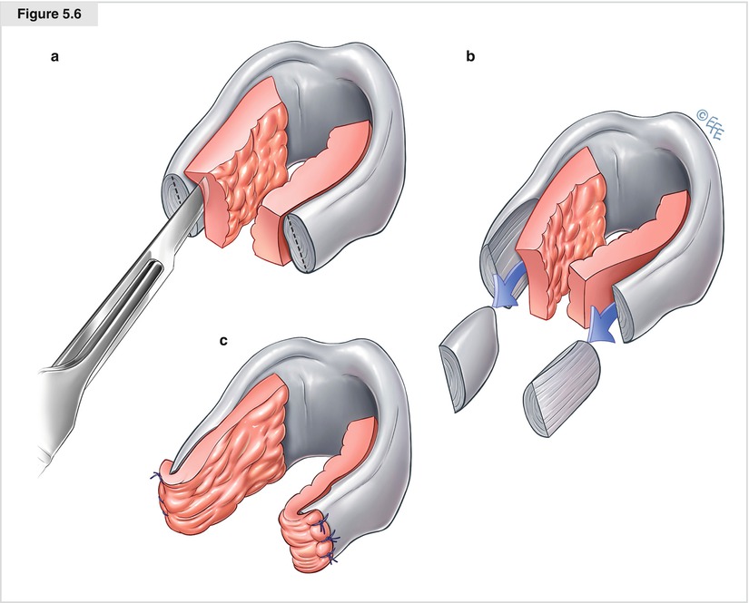 A194303_1_En_5_Fig6_HTML.jpg