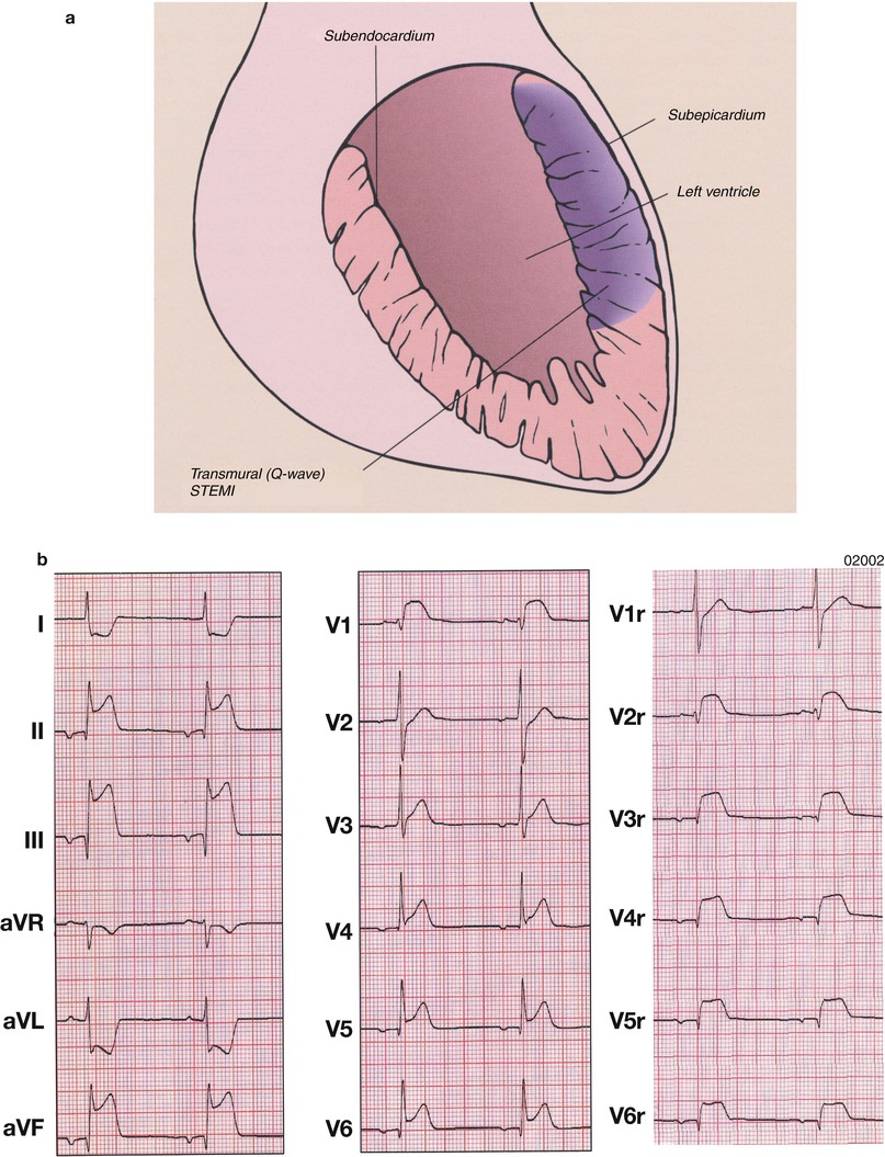 A301956_1_En_15_Fig21_HTML.jpg