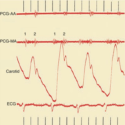 A301956_1_En_15_Fig23_HTML.jpg