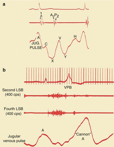 A301956_1_En_15_Fig24_HTML.jpg