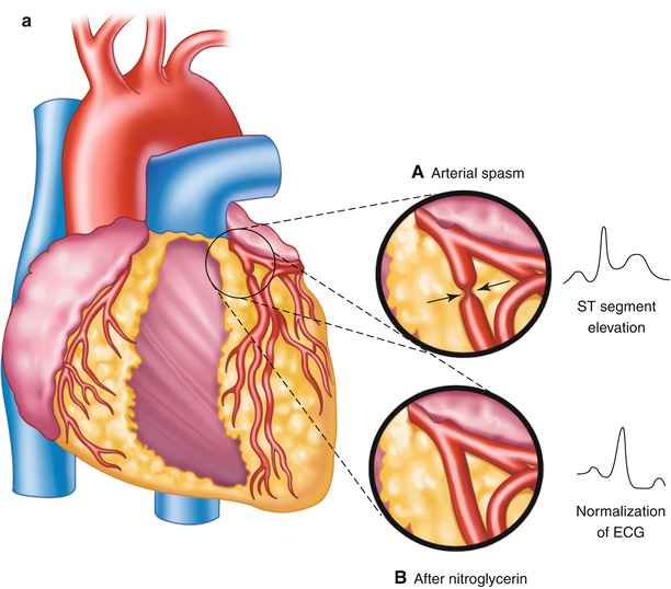 A301956_1_En_15_Fig6a_HTML.jpg