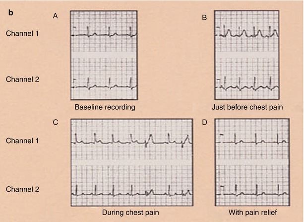 A301956_1_En_15_Fig6b_HTML.jpg