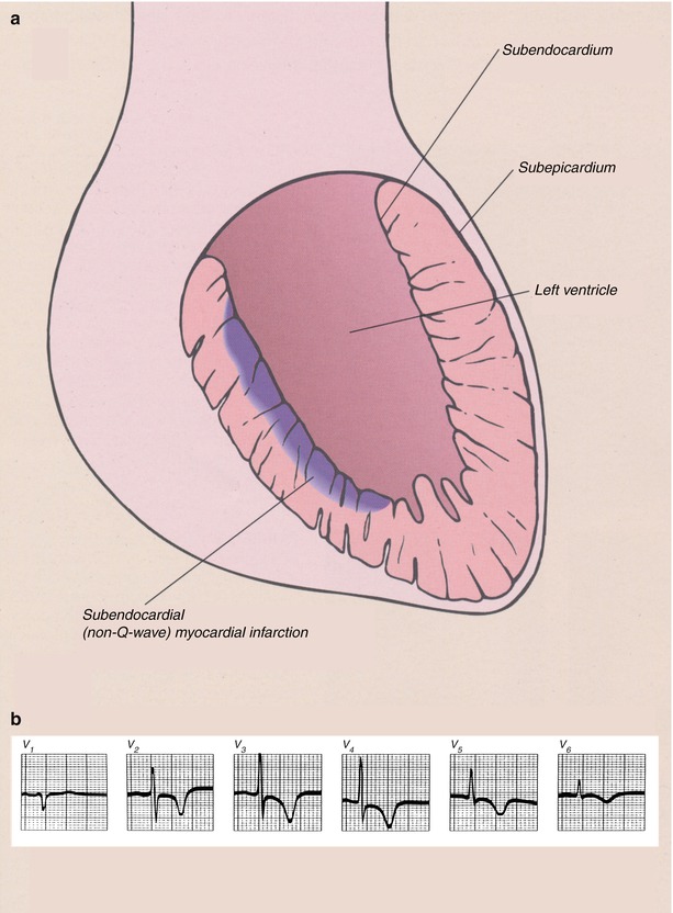 A301956_1_En_15_Fig8_HTML.jpg