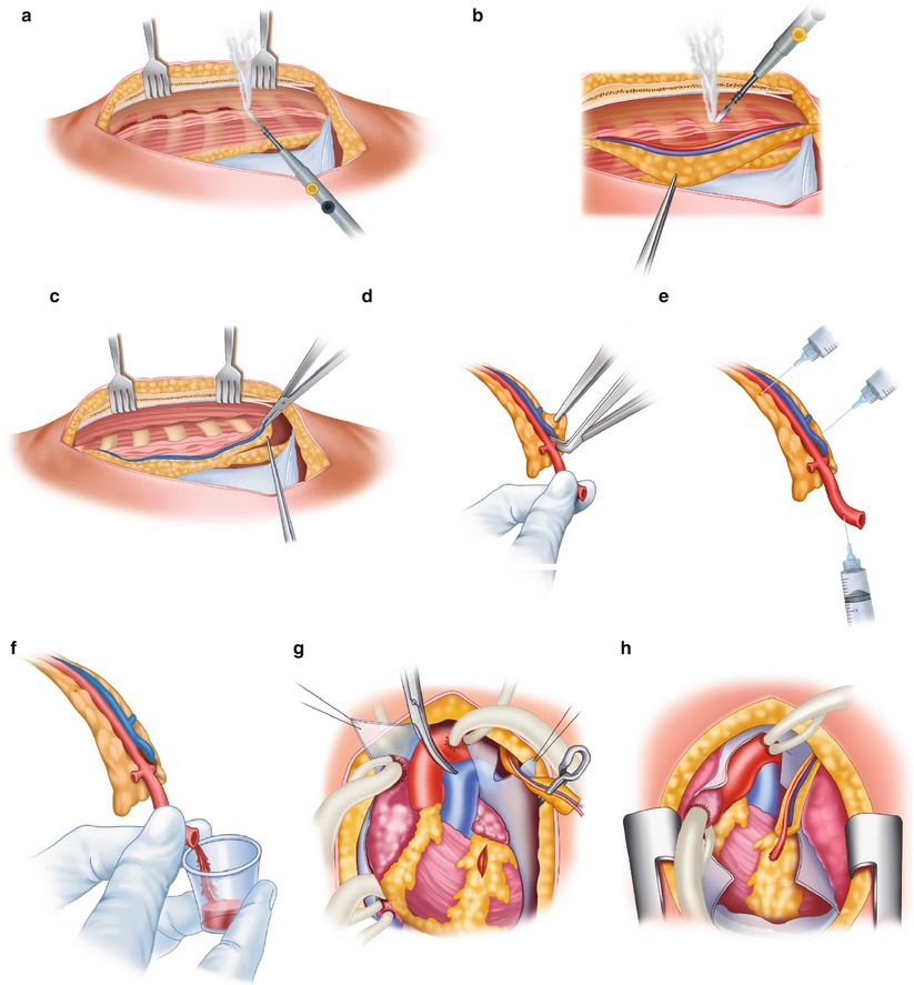 A301956_1_En_25_Fig9_HTML.jpg