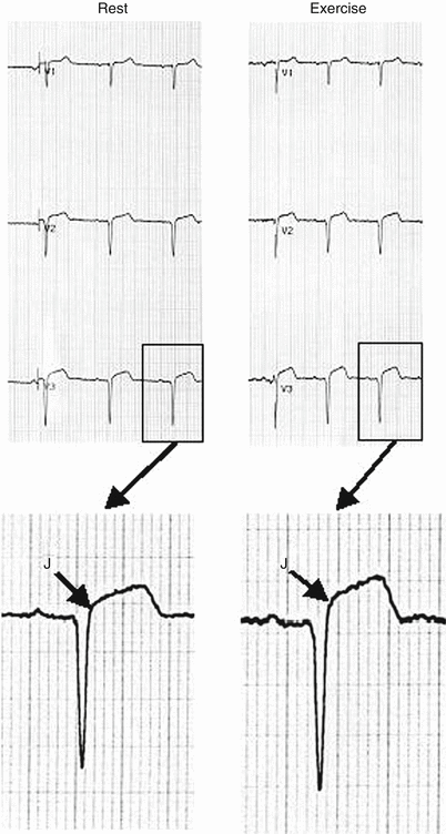 A301956_1_En_8_Fig9_HTML.gif