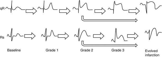 A301956_1_En_9_Fig3_HTML.gif