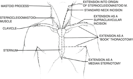 A302161_1_En_11_Fig2_HTML.gif