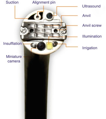 gerd endoscopy findings