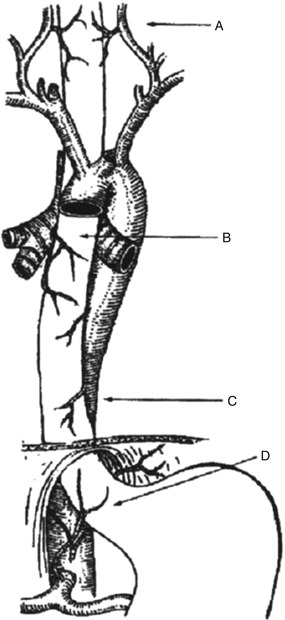 Esophageal Anatomy and Physiology for the Surgeon | Thoracic Key