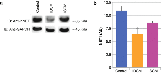 A319641_1_En_1_Fig3_HTML.gif