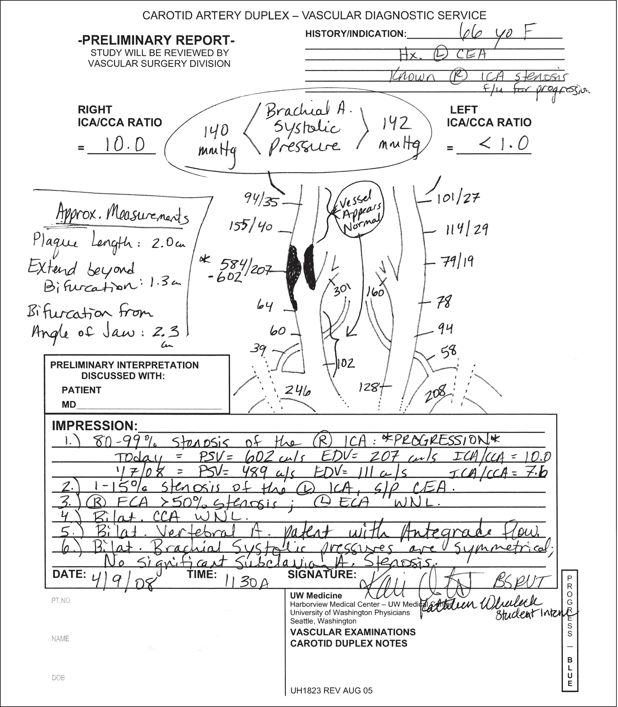 Carotid Doppler Ultrasound Worksheet