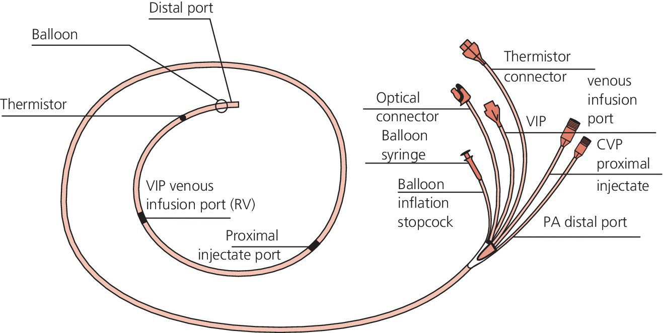 Schematic of PA catheter with lines depicting the distal port, balloon, thermistor, VIP venous infusion port (RV), proximal injectate port, optical connector, balloon syringe, balloon inflation stopcock, etc.