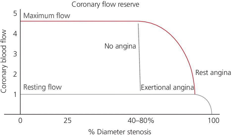 Graph of diameter stenosis vs. coronary blood flow illustrating coronary flow reserve, with horizontal line at 1 (resting flow) and horizontal line at 5 (maximum flow) that then curves downward (rest angina).