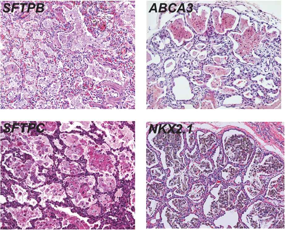 Surfactant During Lung Development | Thoracic Key