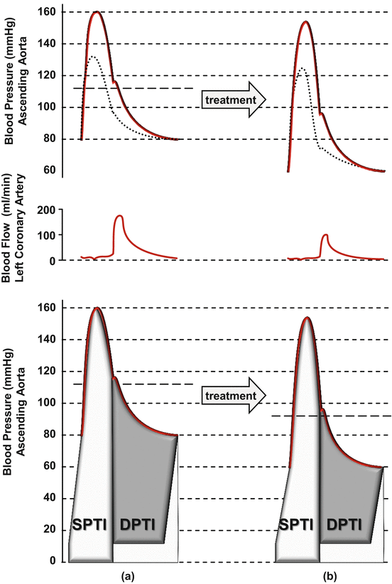 Aortic Stiffness And Myocardial Ischemia | Thoracic Key