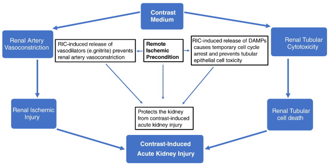 Contrast-induced Acute Kidney Injury In Interventional Cardiology ...