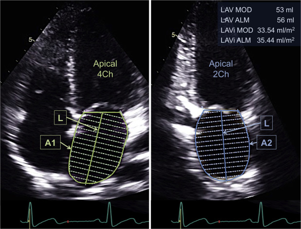 Clinical And Prognostic Implications Of Methods And Partition Values ...