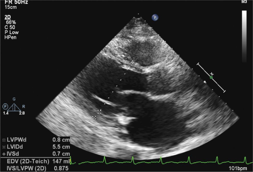 Echocardiographic Assessment Of The Patient With Known Or Suspected ...