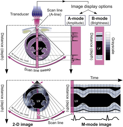 Physical Principles Of Ultrasound And Generation Of Images | Thoracic Key