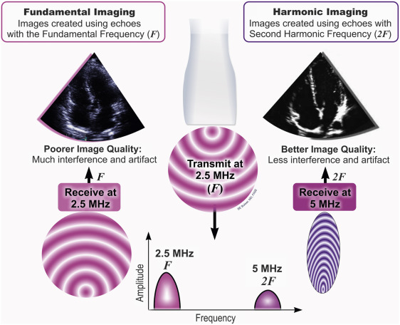 Physical Principles Of Ultrasound And Generation Of Images | Thoracic Key