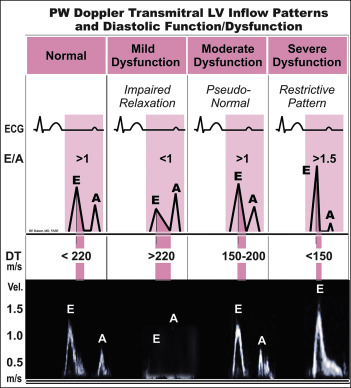 Normal Lv Diastolic Function Paul Smith