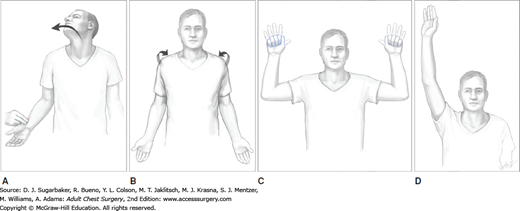 Thoracic Outlet Syndromes | Thoracic Key