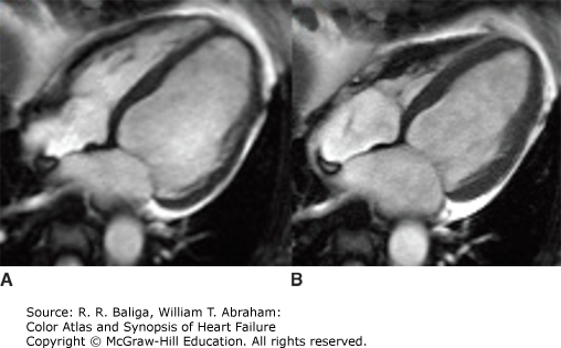 Cardiac Magnetic Resonance Imaging | Thoracic Key