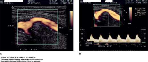 Noninvasive Arterial Imaging | Thoracic Key