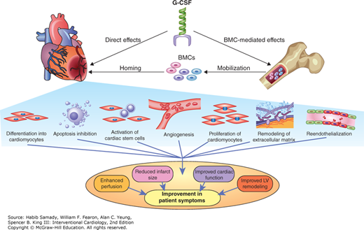 Cell Therapy For Cardiovascular Diseases | Thoracic Key