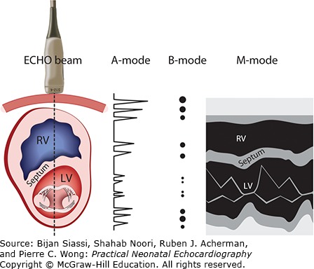 M-Mode Echocardiography And 2D Cardiac Measurements* | Thoracic Key