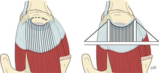 The Rotator Cuff | Thoracic Key