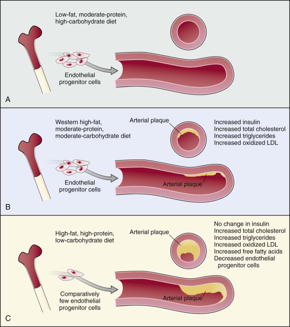 Overweight Obesity And Cardiovascular Risk Thoracic Key