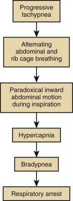 Acute Ventilatory Failure | Thoracic Key