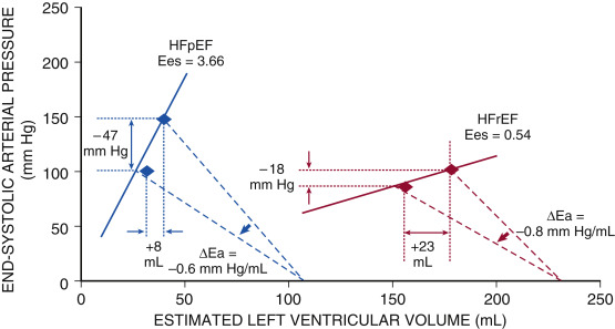 Hemodynamics In Heart Failure | Thoracic Key