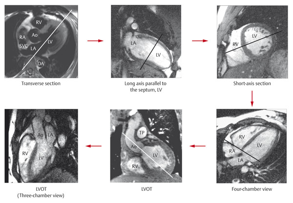 5 Cardiac Magnetic Resonance Imaging And Computed Tomography | Thoracic Key