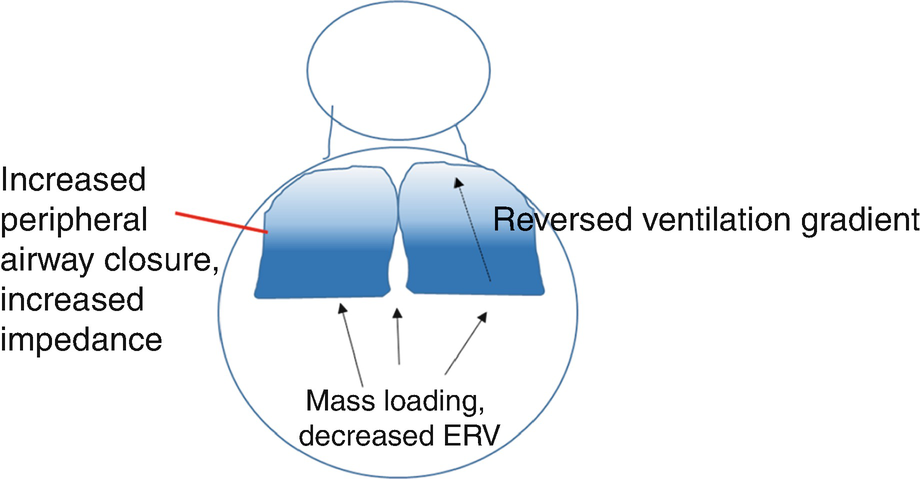 ../images/462502_1_En_12_Chapter/462502_1_En_12_Fig2_HTML.png