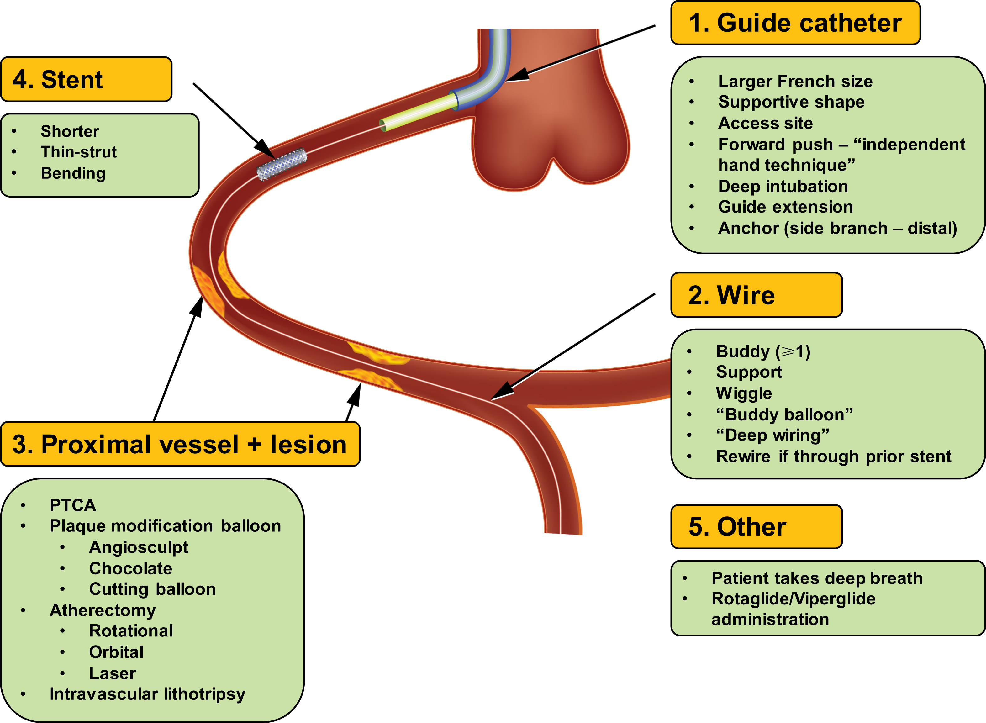 Stenting | Thoracic Key