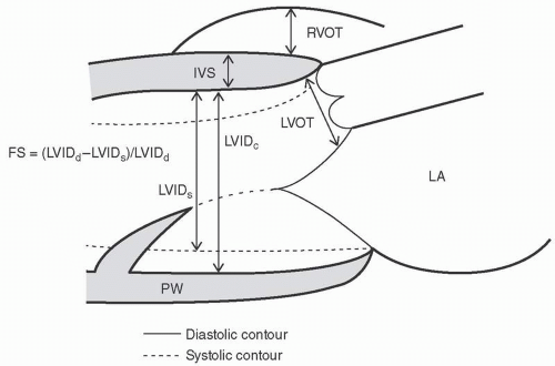 Left Ventricular Systolic Function Thoracic Key