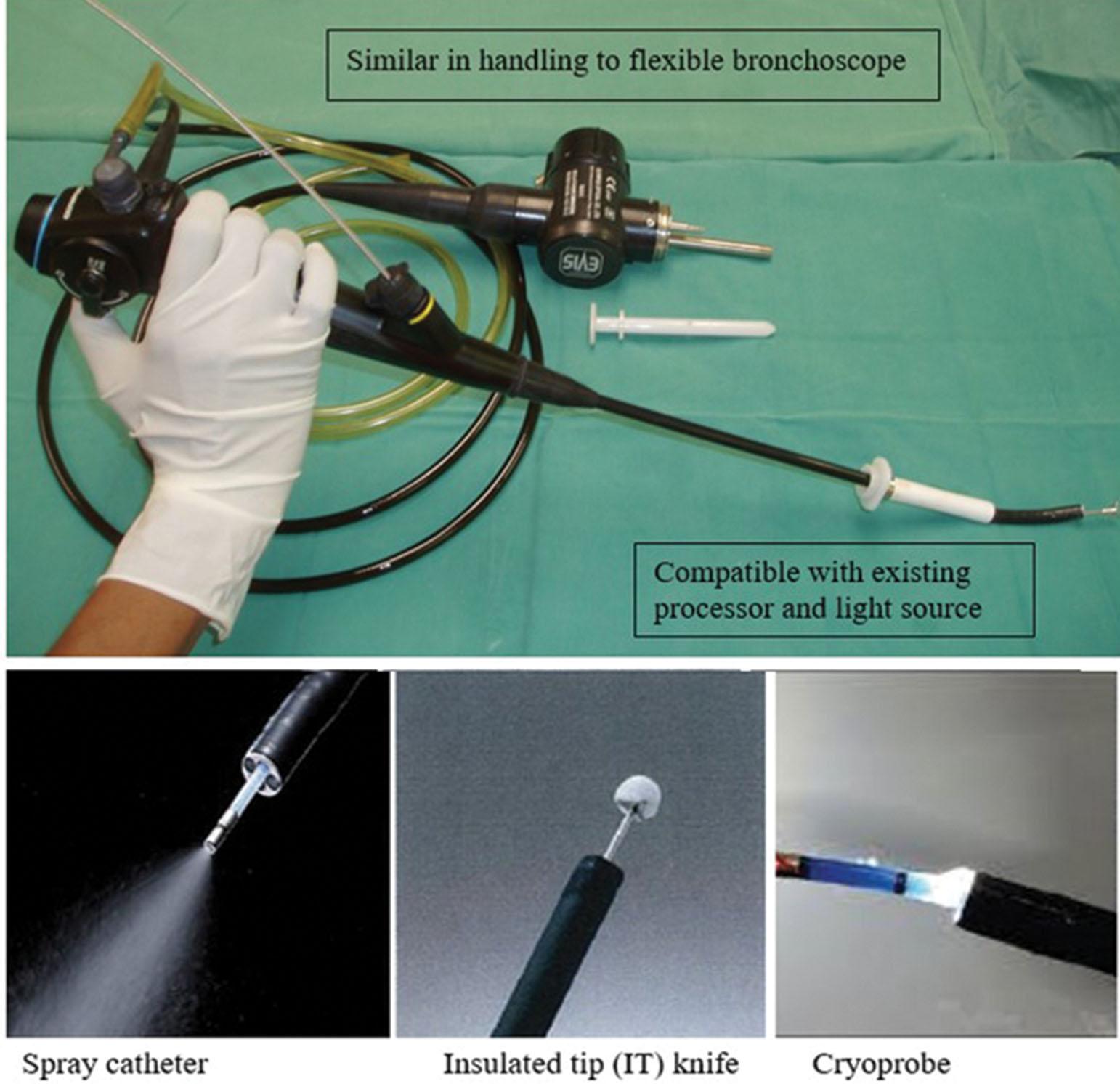 Medical Thoracoscopy | Thoracic Key